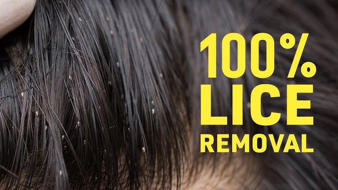 How To Start A Lice Removal Business